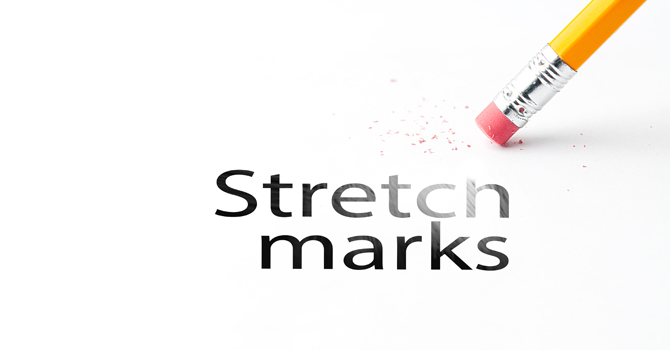 Cara Mudah Menyamarkan Strech Marks